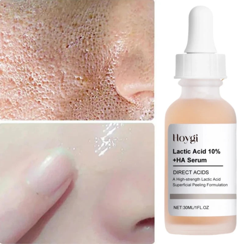 Lactic Acid Face Serum – Tightens Pores & Moisturizes Skin