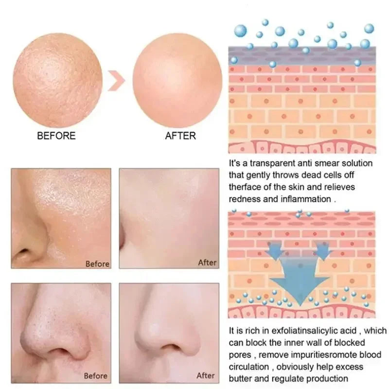 Lactic Acid Face Serum – Tightens Pores & Moisturizes Skin