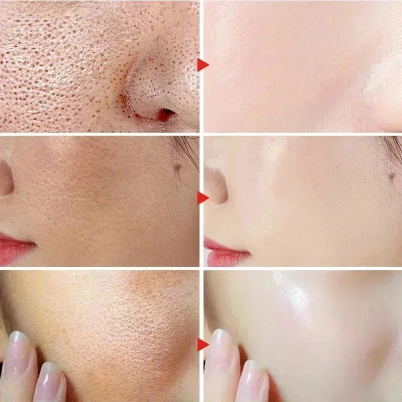 Lactic Acid Face Serum – Tightens Pores & Moisturizes Skin